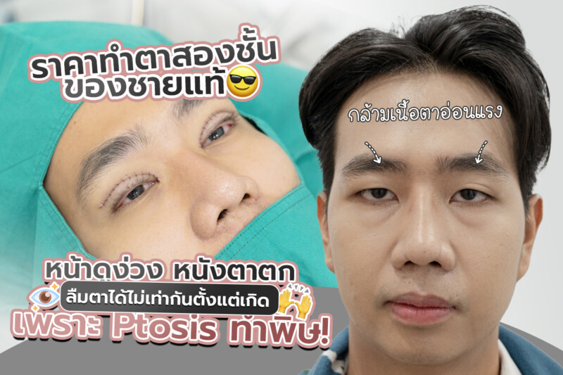 DoctorKai-Office.com คลินิกศัลยกรรม (7) DoctorKai-Office.com คลินิกศัลยกรรม (7)